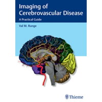 Imaging of Cerebrovascular Disease: A Practical Guide /THIEME MEDICAL PUBL INC/Val M. Runge